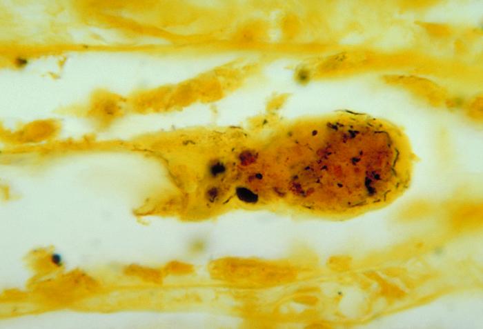 Homeopathy associated with dramatic reduction in Leptospirosis infection in Cuban population